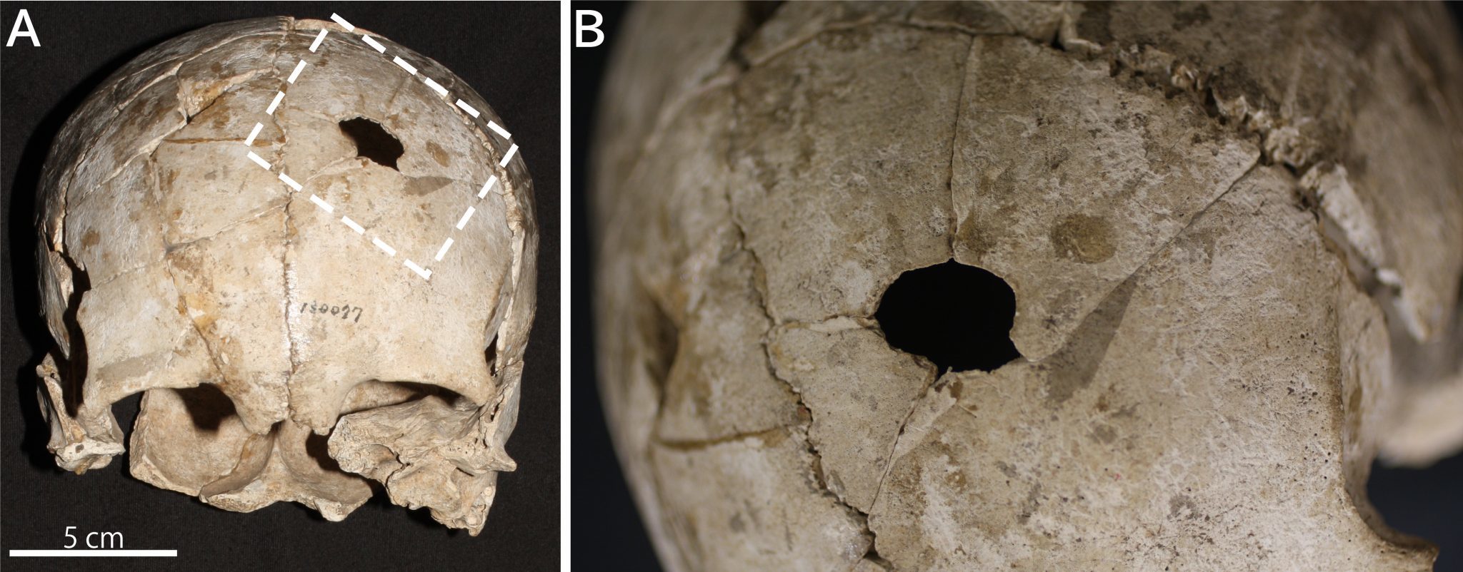 20240508 縄文人の頭骨
